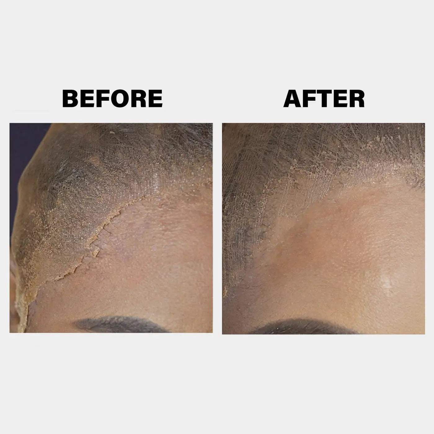 EBIN - Lace Melt Spray à la Vitamine E 80mL